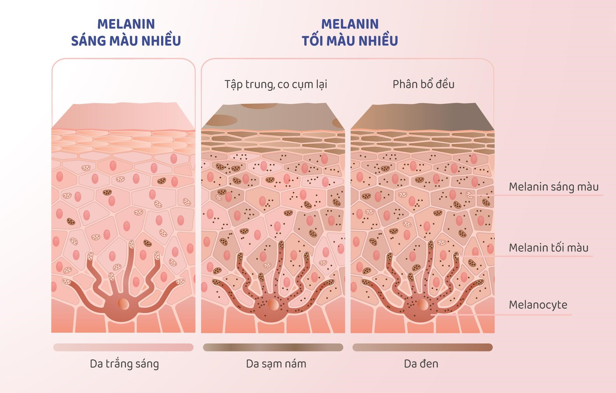 Melanin là gì? Melanin có tác động gì đến làn da của bạn?